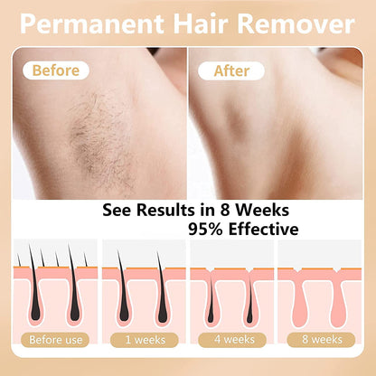 Hair Removal for Women Permanent Hair Removal Device 999,999 Flashes Painless Hair Remover